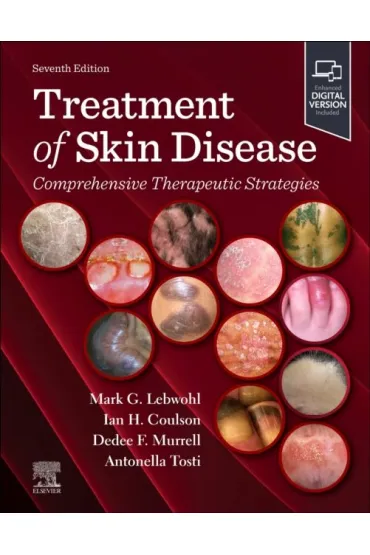Treatment of Skin Disease: Comprehensive Therapeutic Strategies