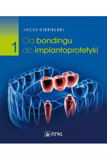 Od bondingu do implantoprotetyki. Tom 1 - Jacek  Ciesielski