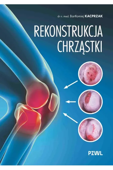 Rekonstrukcja chrz�stki. Ratujemy kolano, nie wymieniamy - Bart�omiej Kacprzak