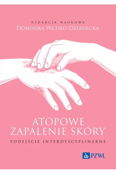 Atopowe zapalenie sk�ry. Podej�cie interdyscyplinarne - Dominika Wcis�o-Dziadecka
