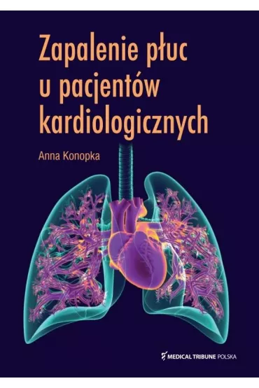 Zapalenie puc u pacjentw kardiologicznych - Anna  Konopka