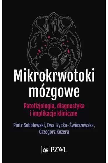 Mikrokrwotoki m�zgowe - Grzegorz Kozera, Piotr Sobolewski, Ewa  I�ycka-�wieszewska
