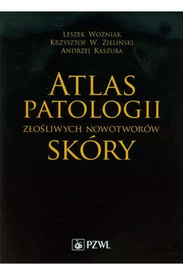 Atlas patologii z�o�liwych nowotwor�w sk�ry - Andrzej Kaszuba, Leszek Wo�niak, Krzysztof W. Zieli�ski