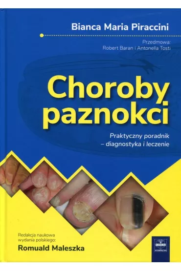 Choroby paznokci Praktyczny poradnik - diagnostyka i leczenie - Maria  Piraccini Bianca