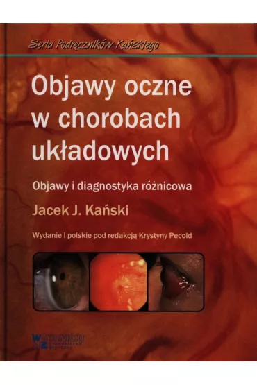 Objawy oczne w chorobach uk�adowych - Jacek J Ka�ski