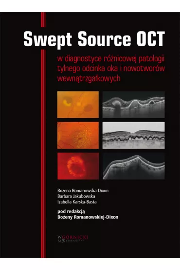 Swept Source OCT w diagnostyce patologii tylnego bieguna oka i nowotwor�w wewn�trzga�kowych - Barbara Jakubowska, Bo�ena Romanowska-Dixon, Izabella  Karska-Basta