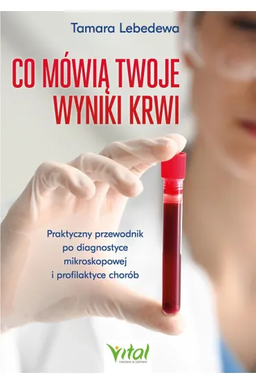Co m�wi� twoje wyniki krwi. Praktyczny przewodnik po diagnostyce mikroskopowej i profilaktyce chor�b - Tamara  Lebedewa