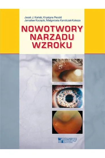 Nowotwory narz�du wzroku - Jacek J Ka�ski, Krystyna Pecold, Jaros�aw Koci�cki, Ma�gorzata Karolczak-Kulesza
