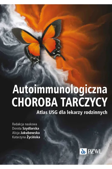 Autoimmunologiczna choroba tarczycy - Katarzyna �yci�ska, Alicja  Jakubowska, Dorota  Szydlarska