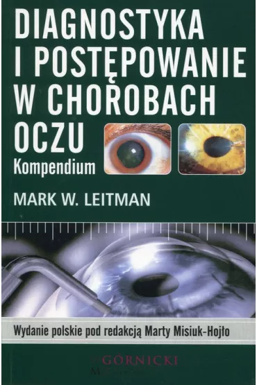 Diagnostyka i post�powanie w chorobach oczu. Kompendium - Mark W Leitman