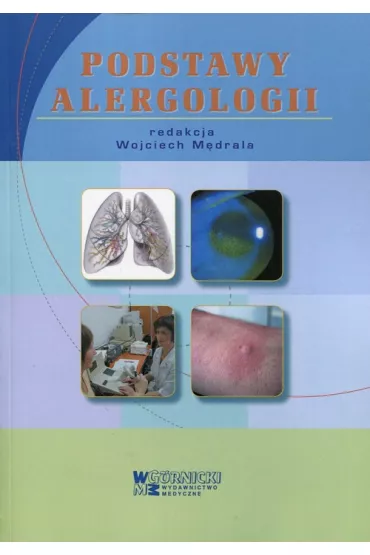 Podstawy alergologii - Wojciech M�drala