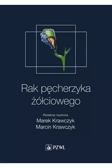 Rak p�cherzyka ��ciowego - Marcin Krawczyk, Marek Krawczyk