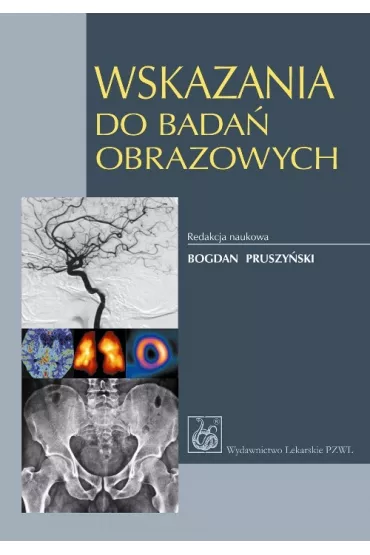 Wskazania do bada� obrazowych - Marek Go��biowski, Laretta Grabowska-Derlatka, Robert Chrzan