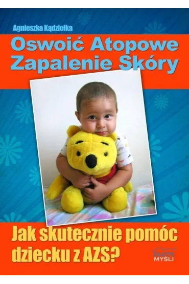 Oswoi� atopowe zapalenie sk�ry - Agnieszka K�dzio�ka
