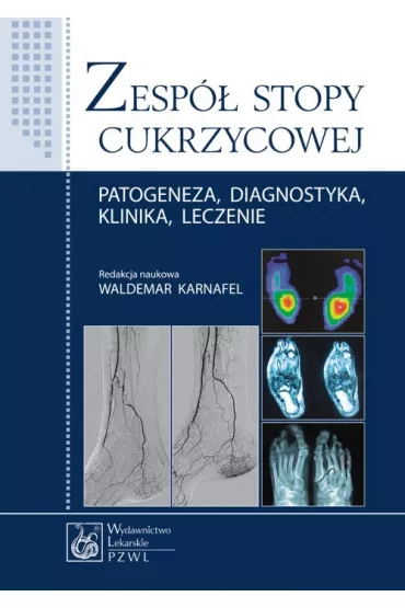 Zesp� stopy cukrzycowej. Patogeneza, diagnostyka, klinika, leczenie - Waldemar Karnafel