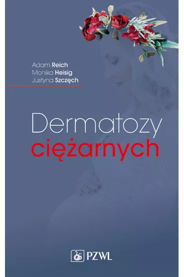 Dermatozy ci�arnych - Adam Reich, Justyna  Szcz�ch, Monika  Heisig