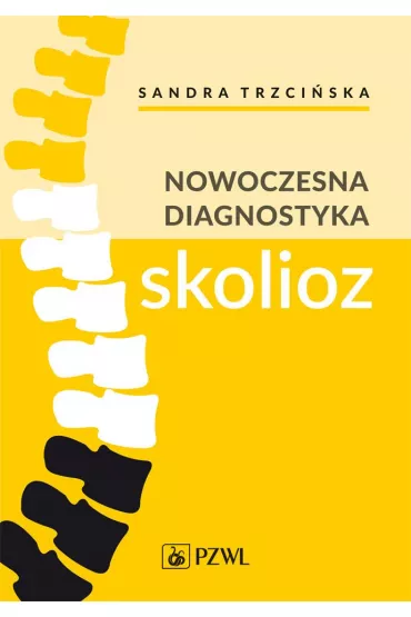Nowoczesna diagnostyka skolioz - Sandra  Trzci�ska