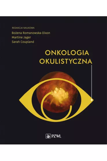 Onkologia okulistyczna - Bo�ena Romanowska-Dixon, Martine Jager
