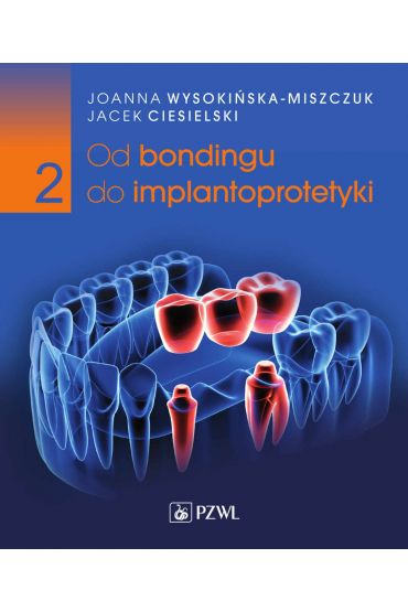 Od bondingu do implantoprotetyki. Cz. II