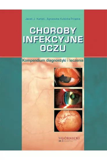 Choroby infekcyjne oczu. Kompendium diagnostyki i leczenia - Jacek J Ka�ski, Agnieszka Kubicka-Trz�ska