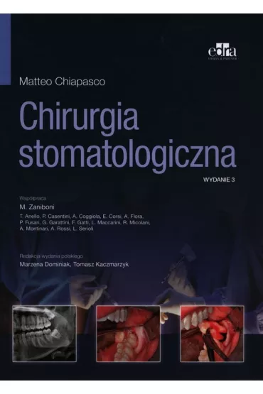 Chirurgia stomatologiczna - M Chiapasco
