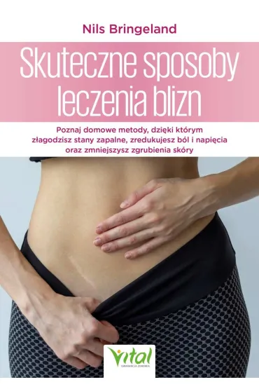 Skuteczne sposoby leczenia blizn - Nils Bringeland