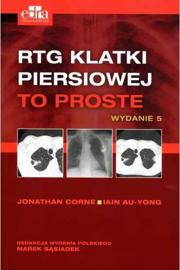 RTG klatki piersiowej - J Corne, I Au-Jong