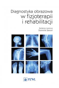 eBook Diagnostyka obrazowa w fizjoterapii i rehabilitacji mobi epub