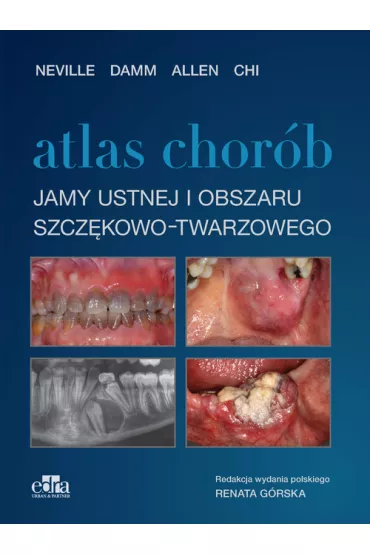 Atlas chor�b jamy ustnej i obszaru szcz�kowo-twarzowego - Brad Neville, Angela Chi, Douglas D. Damm, Carl Allen