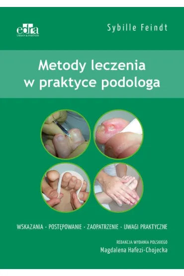 Metody leczenia w podologii - Sybille Feindt