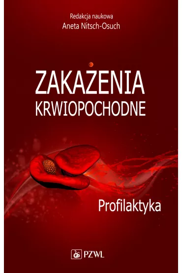 Zaka�enia krwiopochodne. Profilaktyka - Aneta Nitsch-Osuch