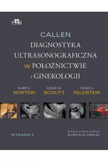 Callen. Diagnostyka ultrasonograficzna w po�o�nictwie i ginekologii. Tom 1 - Vickie A. Feldstein, Mary E. Norton, Leslie M. Scoutt