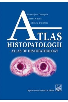 eBook Atlas histopatologii.Tajemniczy wiat chorych komrek czowieka mobi epub