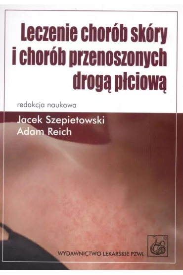 Leczenie chor�b sk�ry i chor�b przenoszonych drog� p�ciow� - Adam Reich, Jacek Szepietowski