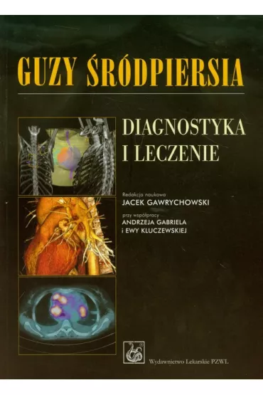 Guzy �r�dpiersia. Diagnostyka i leczenie - Jacek Gawrychowski