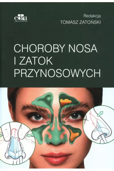 Choroby nosa i zatok przynosowych - Tomasz Zato�ski