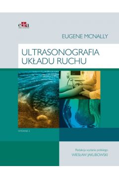 Ultrasonografia ukadu ruchu