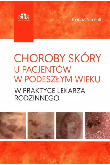 Choroby sk�ry u pacjent�w w podesz�ym wieku w praktyce lekarza rodzinnego - Joanna Narbutt