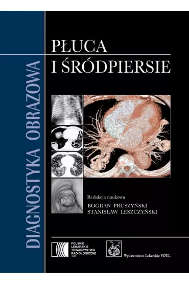 Diagnostyka obrazowa. P�uca i �r�dpiersie