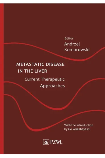 Metastatic Disease in the Liver - Andrzej Komorowski