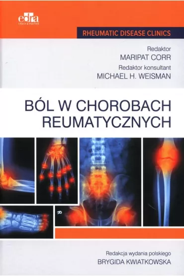 B�l w chorobach reumatycznych - Maripat Corr