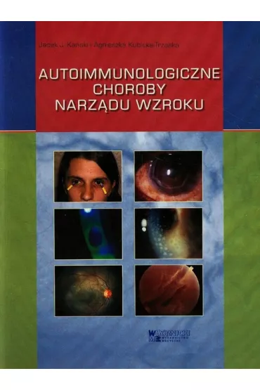 Autoimmunologiczne choroby narz�du wzroku - Jacek J Ka�ski, Agnieszka Kubicka-Trz�ska