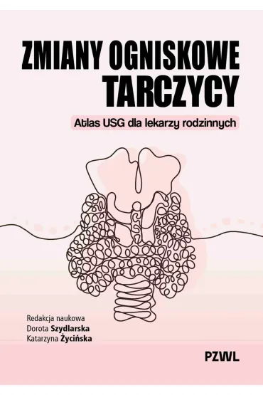 Zmiany ogniskowe tarczycy. Atlas USG dla lekarzy rodzinnych - Dorota  Szydlarska