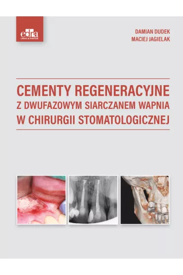 Cementy regeneracyjne z dwufazowym siarczanem wapnia w chirurgii stomatologicznej - Damian Dudek, Maciej Jagielak