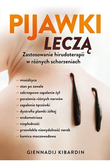 Pijawki lecz - Giennadij Kibardin
