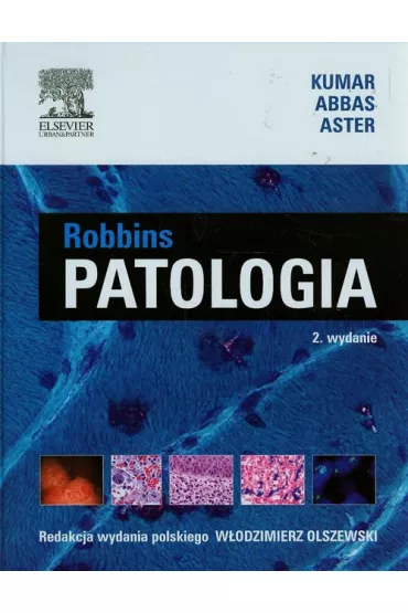 Patologia Robbins - Kumar Vinay, Abul Abbas, C. Jon. Aster