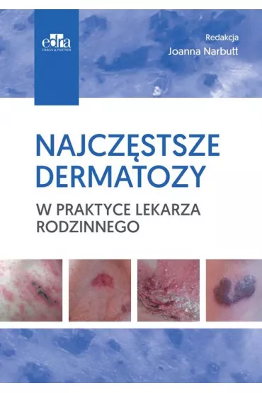 Najcz�stsze dermatozy w praktyce lekarza rodzinn.