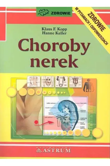 Choroby nerek - Klaus F. Kopp, Hanne Keller