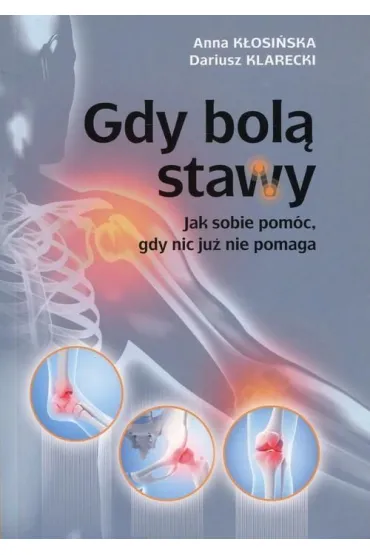 Gdy bol� stawy. Jak sobie pom�c, gdy nic ju� nie pomaga - Anna K�osi�ska , Dariusz Klarecki