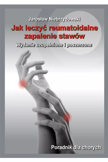 Jak leczy� reumatoidalne zapalenie staw�w - Jaros�aw Niebrzydowski